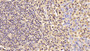 DAB staining on IHC-P; Sample: Human Amygdalitis Tissue; Primary Ab: 10ug/ml Mouse Anti-Multi-species ACTb Antibody; Second Ab: 2ug/mL HRP-Linked Caprine Anti-Mouse IgG Polyclonal Antibody