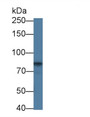 Western Blot; Sample: Bovine Kidney lysate Primary Ab: 4ug/ml Rabbit Anti-Human CDH5 Antibody Second Ab: 0.2ug/mL HRP-Linked Caprine Anti-Rabbit IgG Polyclonal Antibody