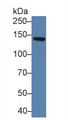 Western Blot; Sample: Human Lung lysate; Primary Ab: 2ug/ml Rabbit Anti-Human CDH5 Antibody; Second Ab: 0.2ug/mL HRP-Linked Caprine Anti-Rabbit IgG Polyclonal Antibody