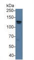 Western Blot; Sample: Human 293T cell lysate; Primary Ab: 2ug/ml Rabbit Anti-Human CDH5 Antibody; Second Ab: 0.2ug/mL HRP-Linked Caprine Anti-Rabbit IgG Polyclonal Antibody