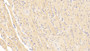DAB staining on IHC-P; Sample: Mouse Cardiac Muscle Tissue; Primary Ab: 20ug/ml Rabbit Anti-Mouse BNP Antibody Second Ab: 2ug/mL HRP-Linked Caprine Anti-Rabbit IgG Polyclonal Antibody