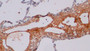 DAB staining on IHC-P; Sample: Human Lung Tissue; Primary Ab: 10ug/ml Rabbit Anti-Human CTXI Antibody Second Ab: 2ug/mL HRP-Linked Caprine Anti-Rabbit IgG Polyclonal Antibody