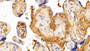 DAB staining on IHC-P; Samples: Human Placenta Tissue; Primary Ab: 10ug/ml Rabbit Anti-Porcine FG Antibody Second Ab: 2ug/mL HRP-Linked Caprine Anti-Rabbit IgG Polyclonal Antibody