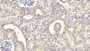 DAB staining on IHC-P; Sample: Human Kidney Tissue; Primary Ab: 40ug/ml Mouse Anti-Human FAPa Antibody Second Ab: 2ug/mL HRP-Linked Caprine Anti-Mouse IgG Polyclonal Antibody
