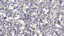 DAB staining on IHC-P; Sample: Human Small intestine Tissue; Primary Ab: 40ug/ml Mouse Anti-Human FAPa Antibody; Second Ab: 2ug/mL HRP-Linked Caprine Anti-Mouse IgG Polyclonal Antibody