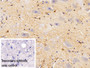 DAB staining on IHC-P; Sample: Rat Spinal cord Tissue; Primary Ab: 10ug/ml Rabbit Anti-Rat GSK3b Antibody; Control: Used PBS instead of primary antibody; Second Ab: 2ug/ml HRP-Linked Caprine Anti-Rabbit IgG Polyclonal Antibody