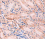 Used in DAB staining on fromalin fixed paraffin- embedded kidney tissue