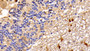 DAB staining on IHC-P; Sample: Human Cerebellum Tissue; Primary Ab: 20ug/ml Mouse Anti-Human PTEN Antibody; Second Ab: 2ug/mL HRP-Linked Caprine Anti-Mouse IgG Polyclonal Antibody