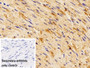 DAB staining on IHC-P; Sample: Rat Cardiac Muscle Tissue; Primary Ab: 10ug/ml Rabbit Anti-Rat RELA Antibody; Control: Used PBS instead of primary antibody; Second Ab: 2ug/ml HRP-Linked Caprine Anti-Rabbit IgG Polyclonal Antibody