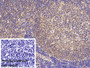 DAB staining on IHC-P; Sample: Porcine Lymph node Tissue Primary Ab: 20ug/ml Rabbit Anti-Human NUMA1 Antibody Control: Used PBS instead of primary antibody Second Ab: 2ug/ml HRP-Linked Caprine Anti-Rabbit IgG Polyclonal Antibody