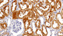DAB staining on IHC-P; Sample: Human Kidney Tissue; Primary Ab: 20ug/ml Rabbit Anti-Human ATG5 Antibody Second Ab: 2ug/mL HRP-Linked Caprine Anti-Rabbit IgG Polyclonal Antibody