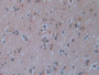 DAB staining on IHC-P; Sample: Human Cerebrum Tissue; Primary Ab: 40ug/ml Mouse Anti-Multi-species CTXI Antibody Second Ab: 2ug/mL HRP-Linked Caprine Anti-Mouse IgG Polyclonal Antibody