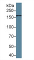 Western Blot; Sample: Human 293T cell lysate; Primary Ab: 2ug/ml Rabbit Anti-Human MRC2 Antibody; Second Ab: 0.2ug/mL HRP-Linked Caprine Anti-Rabbit IgG Polyclonal Antibody