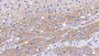 DAB staining on IHC-P; Sample: Rat Cerebrum Tissue; Primary Ab: 20ug/ml Mouse Anti-Human NEFL Antibody Second Ab: 2ug/mL HRP-Linked Caprine Anti-Mouse IgG Polyclonal Antibody