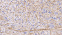 DAB staining on IHC-P; Sample: Rat Spinal cord Tissue; Primary Ab: 20ug/ml Mouse Anti-Human NEFL Antibody; Second Ab: 2ug/mL HRP-Linked Caprine Anti-Mouse IgG Polyclonal Antibody