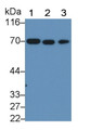 Western Blot; Sample: Lane1: Porcine Cerebrum lysate; Lane2: Rat Cerebrum lysate; Lane3: Mouse Cerebrum lysate Primary Ab: 0.001ug/ml Mouse Anti-Human NEFL Antibody Second Ab: 0.2ug/mL HRP-Linked Caprine Anti-Mouse IgG Polyclonal Antibody