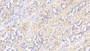 DAB staining on IHC-P; Sample: Human Stomach Tissue; Primary Ab: 20ug/ml Mouse Anti-Human MMP7 Antibody; Second Ab: 2ug/mL HRP-Linked Caprine Anti-Mouse IgG Polyclonal Antibody