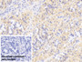 DAB staining on IHC-P; Sample: Human Stomach Tissue; Primary Ab: 20ug/ml Mouse Anti-Human MMP7 Antibody; Control: Used PBS instead of primary antibody; Second Ab: 2ug/ml HRP-Linked Caprine Anti-Mouse IgG Polyclonal Antibody