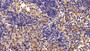 DAB staining on IHC-P; Sample: Rat Lymph node Tissue; Primary Ab: 10ug/ml Rabbit Anti-Mouse FFAR2 Antibody; Second Ab: 2ug/mL HRP-Linked Caprine Anti-Rabbit IgG Polyclonal Antibody