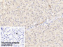 DAB staining on IHC-P; Sample: Human Liver Tissue; Primary Ab: 30ug/ml Mouse Anti-Human APOB100 Antibody; Control: Used PBS instead of primary antibody; Second Ab: 2ug/ml HRP-Linked Caprine Anti-Mouse IgG Polyclonal Antibody