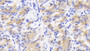 DAB staining on IHC-P; Sample: Human Stomach Tissue; Primary Ab: 30ug/ml Mouse Anti-Human BECN1 Antibody; Second Ab: 2ug/mL HRP-Linked Caprine Anti-Mouse IgG Polyclonal Antibody