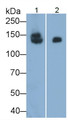 Western Blot; Sample: Lane1: Rat Small intestine lysate; Lane2: Porcine Small intestine lysate Primary Ab: 0.1ug/ml Mouse Anti-Human SI Antibody Second Ab: 0.2ug/mL HRP-Linked Caprine Anti-Mouse IgG Polyclonal Antibody
