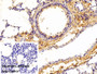 DAB staining on IHC-P; Sample: Mouse Lung Tissue; Primary Ab: 10ug/ml Rabbit Anti-Gallus COL1a2 Antibody; Control: Used PBS instead of primary antibody; Second Ab: 2ug/ml HRP-Linked Caprine Anti-Rabbit IgG Polyclonal Antibody