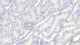 DAB staining on IHC-P; Samples: Porcine Kidney Tissue; Primary Ab: 20ug/ml Rabbit Anti-Human TSC1 Antibody Second Ab: 2ug/mL HRP-Linked Caprine Anti-Rabbit IgG Polyclonal Antibody