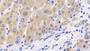 DAB staining on IHC-P; Sample: Human Liver Tissue; Primary Ab: 20ug/ml Rabbit Anti-Human TSC1 Antibody; Second Ab: 2ug/mL HRP-Linked Caprine Anti-Rabbit IgG Polyclonal Antibody