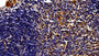 DAB staining on IHC-P; Sample: Rat Thymus Tissue; Primary Ab: 20ug/ml Mouse Anti-Multi-species STAT3 Antibody; Second Ab: 2ug/mL HRP-Linked Caprine Anti-Mouse IgG Polyclonal Antibody
