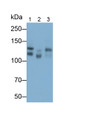 Western Blot; Samples: Lane1: Mouse Cerebrum lysate; Lane2: Mouse Cerebellum lysate; Lane3: Rat Cerebrum lysate; Primary Ab: 0.3ug/ml Rabbit Anti-Mouse CD56 Antibody; Second Ab: 0.2ug/ml HRP-Linked Caprine Anti-Rabbit IgG Polyclonal Antibody