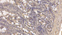 DAB staining on IHC-P; Sample: Human Small intestine Tissue; Primary Ab: 30ug/ml Mouse Anti-Human FAPa Antibody Second Ab: 2ug/mL HRP-Linked Caprine Anti-Mouse IgG Polyclonal Antibody