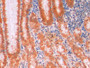 DAB staining on IHC-P; Sample: Human Stomach Tissue; Primary Ab: 10ug/ml Mouse Anti-Human β-catenin Antibody; Second Ab: 2ug/mL HRP-Linked Caprine Anti-Mouse IgG Polyclonal Antibody