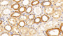 DAB staining on IHC-P; Samples: Human Kidney Tissue; Primary Ab: 20ug/ml Rabbit Anti-Human C5 Antibody; Second Ab: 2ug/mL HRP-Linked Caprine Anti-Rabbit IgG Polyclonal Antibody