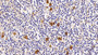 DAB staining on IHC-P; Samples: Human amygdalitis Tissue; Primary Ab: 20ug/ml Rabbit Anti-Human C5 Antibody; Second Ab: 2ug/mL HRP-Linked Caprine Anti-Rabbit IgG Polyclonal Antibody