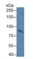 Western Blot; Sample: Human Serum Primary Ab: 2ug/ml Mouse Anti-Human PLOD2 Antibody Second Ab: 0.2ug/mL HRP-Linked Caprine Anti-Mouse IgG Polyclonal Antibody