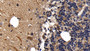 DAB staining on IHC-P; Sample: Human Cerebellum Tissue; Primary Ab: 10ug/ml Rabbit Anti-Human Ab1-40 Antibody Second Ab: 2ug/mL HRP-Linked Caprine Anti-Rabbit IgG Polyclonal Antibody