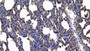 DAB staining on IHC-P; Sample: Human Lung Tissue; Primary Ab: 10ug/ml Rabbit Anti-Human ANXA2 Antibody; Second Ab: 2ug/mL HRP-Linked Caprine Anti-Rabbit IgG Polyclonal Antibody