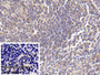 DAB staining on IHC-P; Sample: Porcine Spleen Tissue Primary Ab: 30ug/ml Mouse Anti-Human CD63 Antibody Control: Used PBS instead of primary antibody Second Ab: 2ug/ml HRP-Linked Caprine Anti-Mouse IgG Polyclonal Antibody