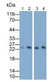 Western Blot; Samples: Lane1: Hela cell lysate; Lane2: A431 cell lysate; Lane3: HepG2 cell lysate; Lane4: HCT116 cell lysate; Primary Ab: 0.3ug/ml Mouse Anti-Human MRP1 Antibody; Second Ab: 0.2ug/ml HRP-Linked Caprine Anti-Mouse IgG Polyclonal Antibody