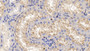 DAB staining on IHC-P; Samples: Porcine Kidney Tissue; Primary Ab: 20ug/ml Rabbit Anti-Porcine APOA1 Antibody Second Ab: 2ug/mL HRP-Linked Caprine Anti-Rabbit IgG Polyclonal Antibody