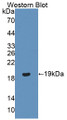 Western Blot; Sample: Recombinant PGR, Human.