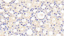 DAB staining on IHC-P; Sample: Human Kidney Tissue; Primary Ab: 20ug/ml Mouse Anti-Human Kim1 Antibody Second Ab: 2ug/mL HRP-Linked Caprine Anti-Mouse IgG Polyclonal Antibody