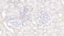 DAB staining on IHC-P; Sample: Human Kidney Tissue; Primary Ab: 20ug/ml Mouse Anti-Human GREM1 Antibody Second Ab: 2ug/mL HRP-Linked Caprine Anti-Mouse IgG Polyclonal Antibody