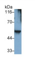 Western Blot; Sample: Human Placenta lysate Primary Ab: 0.1ug/ml Mouse Anti-Human Des Antibody Second Ab: 0.2ug/mL HRP-Linked Caprine Anti-Mouse IgG Polyclonal Antibody