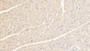 DAB staining on IHC-P; Samples: Human Cardiac Muscle Tissue; Primary Ab: 30ug/ml Mouse Anti-Human FIS1 Antibody; Second Ab: 2ug/mL HRP-Linked Caprine Anti-Mouse IgG Polyclonal Antibody