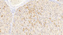 DAB staining on IHC-P; Sample: Human Liver Tissue; Primary Ab: 20ug/ml Mouse Anti-Human a1AT Antibody; Second Ab: 2ug/mL HRP-Linked Caprine Anti-Mouse IgG Polyclonal Antibody