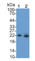 Western Blot; Sample: Lane1: Human Serum; Lane2: Human Urine Primary Ab: 2ug/ml Mouse Anti-Human NGAL Antibody Second Ab: 0.2ug/mL HRP-Linked Caprine Anti-Mouse IgG Polyclonal Antibody