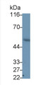 Western Blot; Sample: Porcine Heart lysate Primary Ab: 0.4ug/ml Mouse Anti-Human VIM Antibody Second Ab: 0.2ug/mL HRP-Linked Caprine Anti-Mouse IgG Polyclonal Antibody