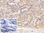DAB staining on IHC-P; Sample: Human Small intestine Tissue; Primary Ab: 30ug/ml Mouse Anti-Human C5a Antibody; Control: Used PBS instead of primary antibody; Second Ab: 2ug/ml HRP-Linked Caprine Anti-Mouse IgG Polyclonal Antibody